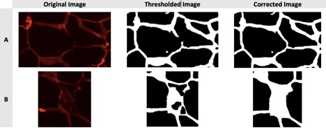 Visual examples of thresholded fat tissue images before and after manual correction.